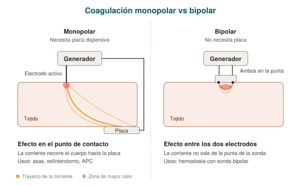 Coagulación monopolar vs bipolar